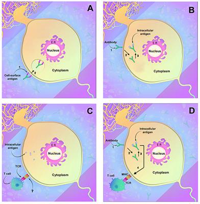 Paraneoplastic and Other Autoimmune Encephalitides: Antineuronal Antibodies, T Lymphocytes, and Questions of Pathogenesis